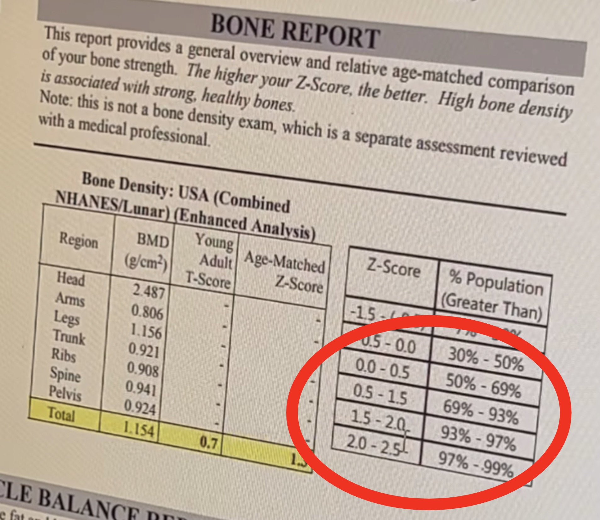 Kim Kardashian Gets a Full Body Scan and Shares Her Bone Density