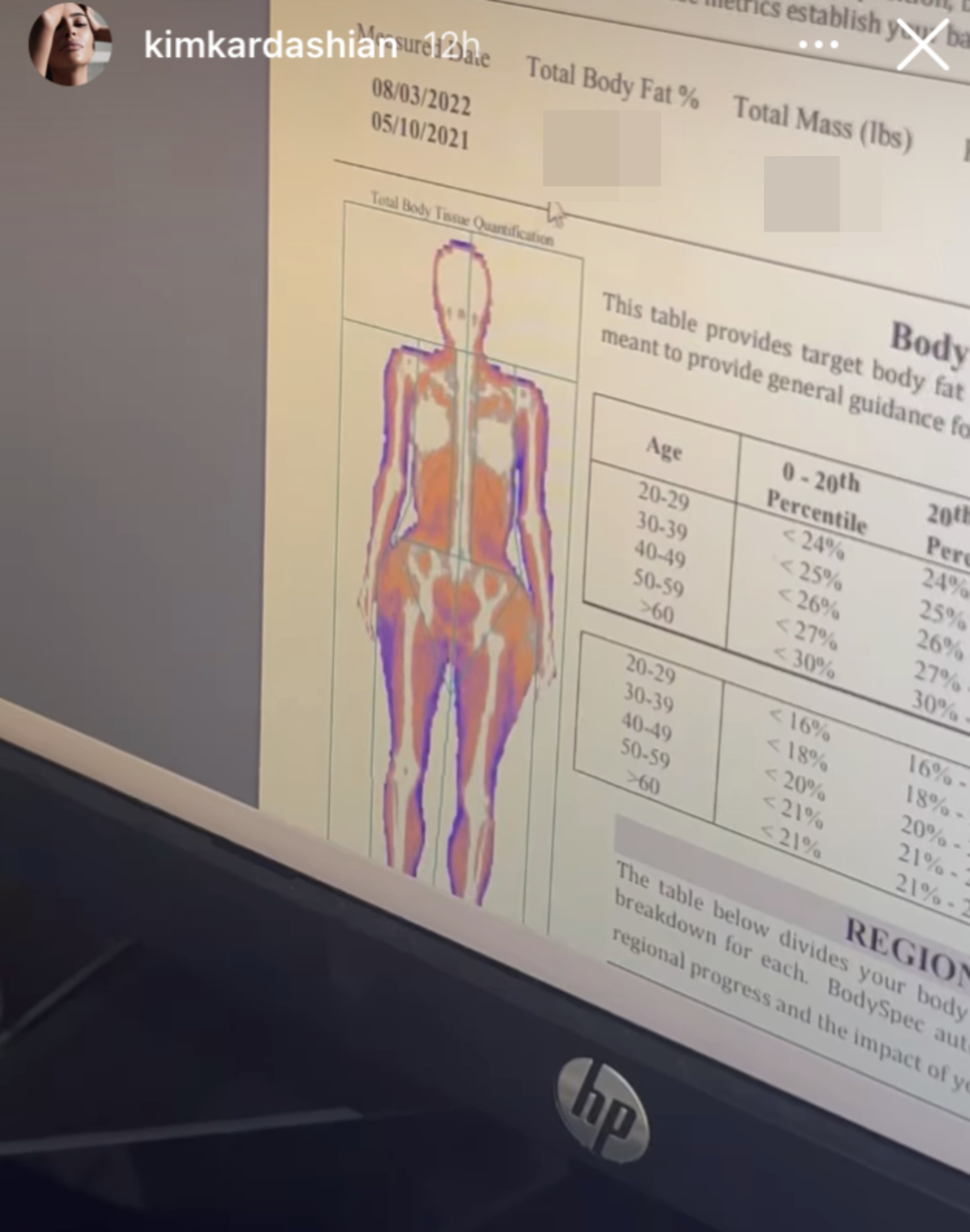 Kim Kardashian Gets a Full Body Scan and Shares Her Bone Density