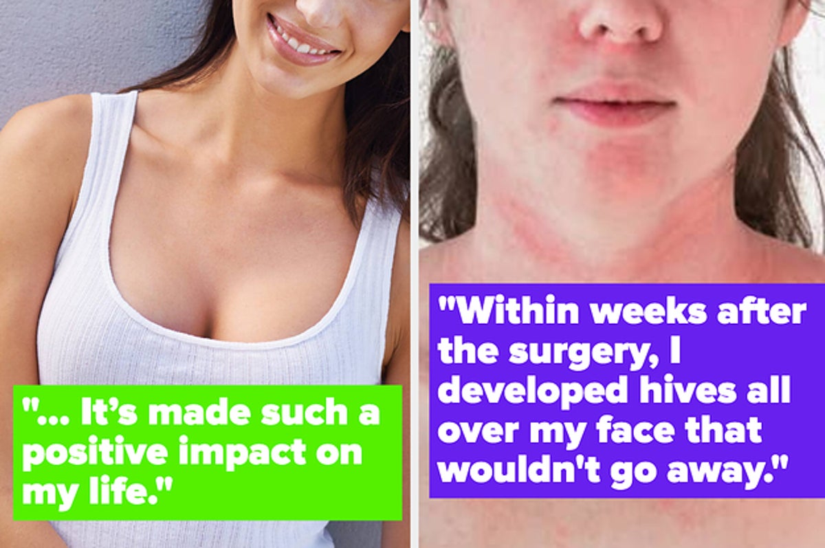 People Are Opening Up About Their Plastic Surgeries