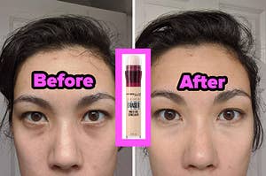 before and after of undereye circles that has used maybelline