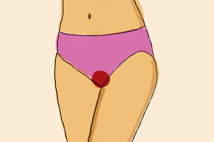 illustration of bleeding through underwear