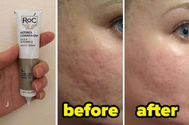retinol cream and a before and after photo of someone who used the cream