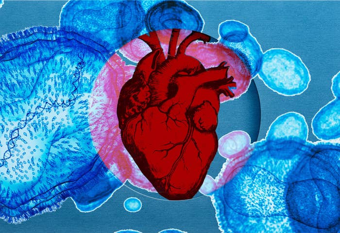 A red anatomical illustration of a heart with the monkeypox virus, illustrated in blue, surrounds the heart