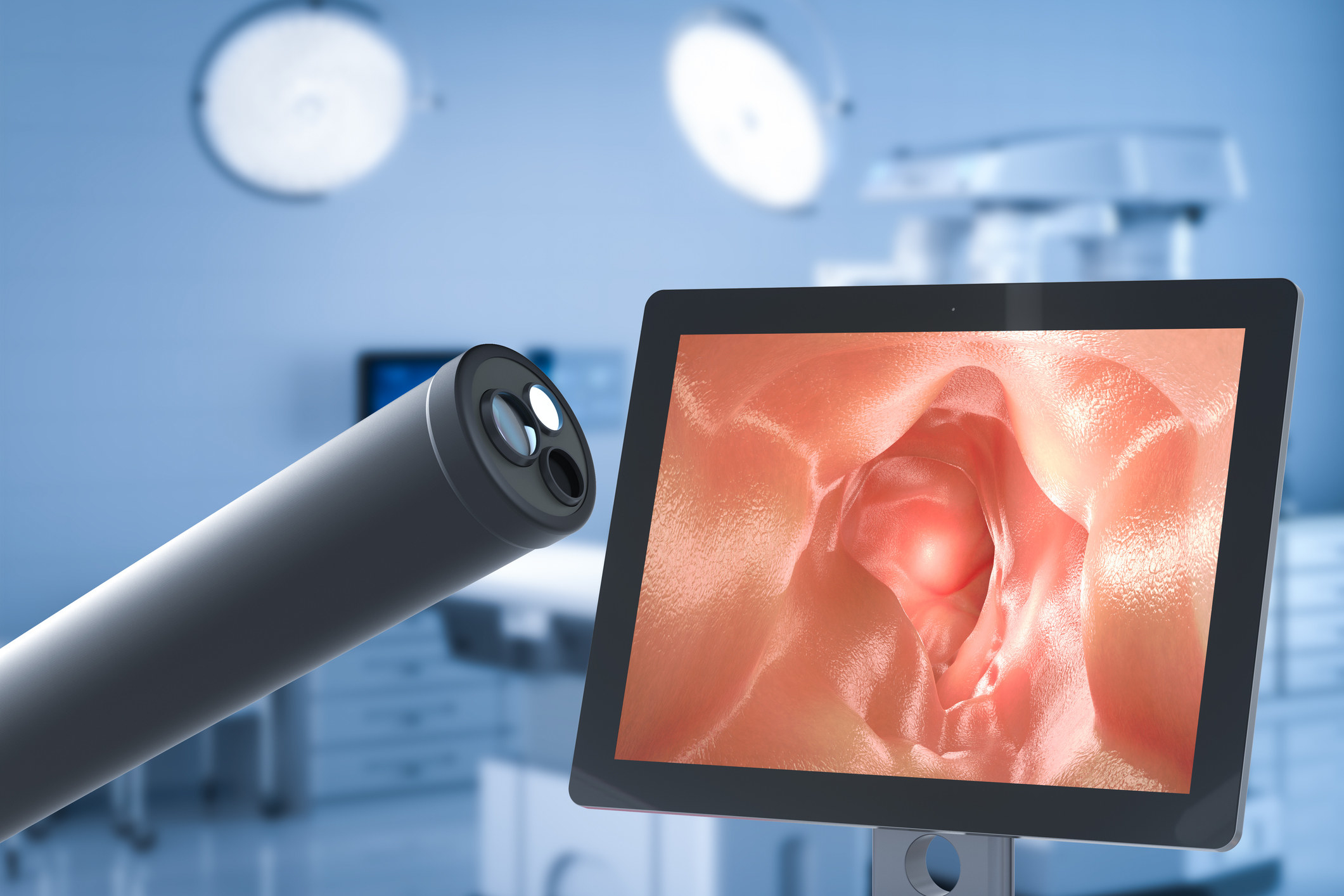 A screen and image machine for a colonoscopy