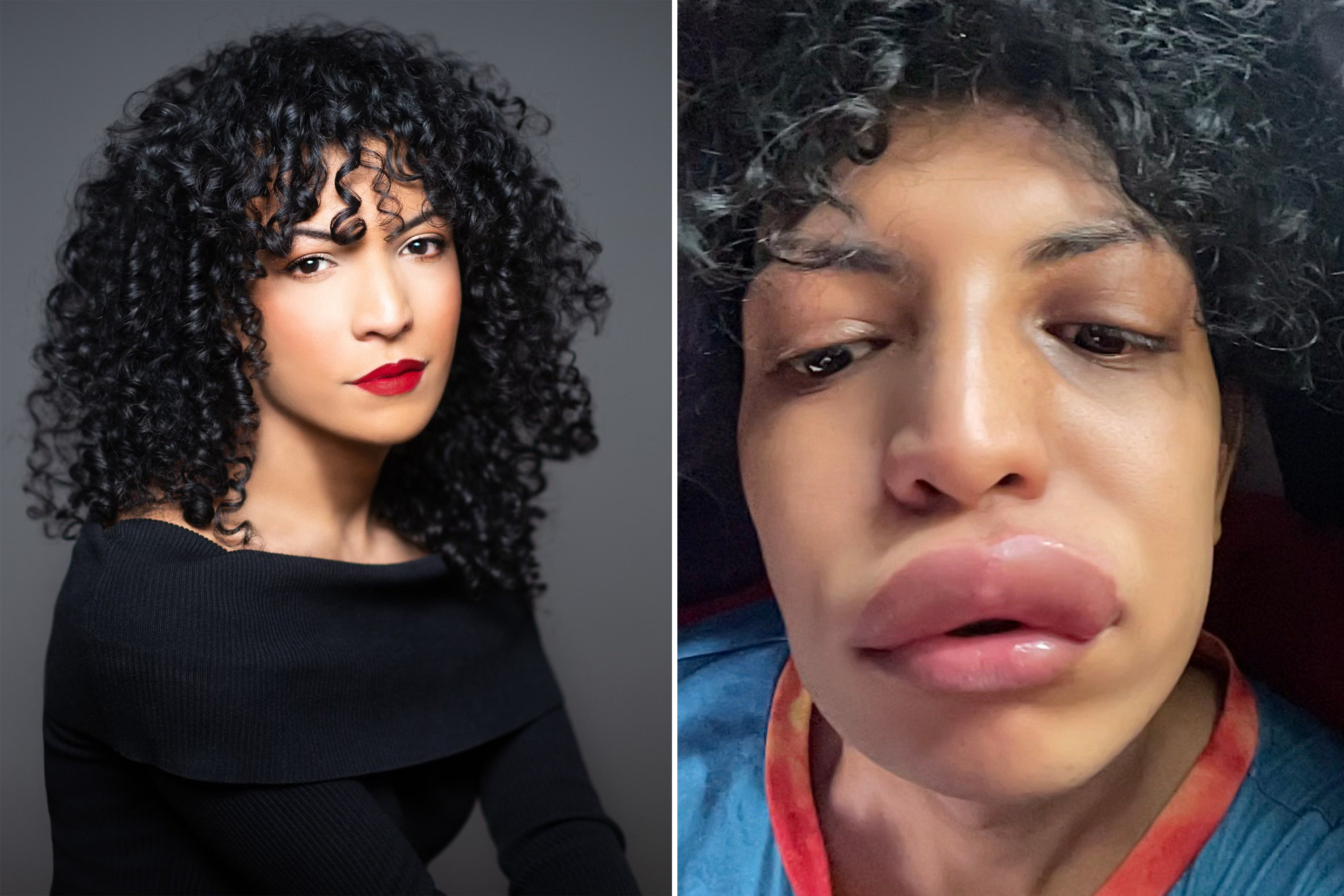 Why Are My Lips Itchy After Kissing Lipstutorial