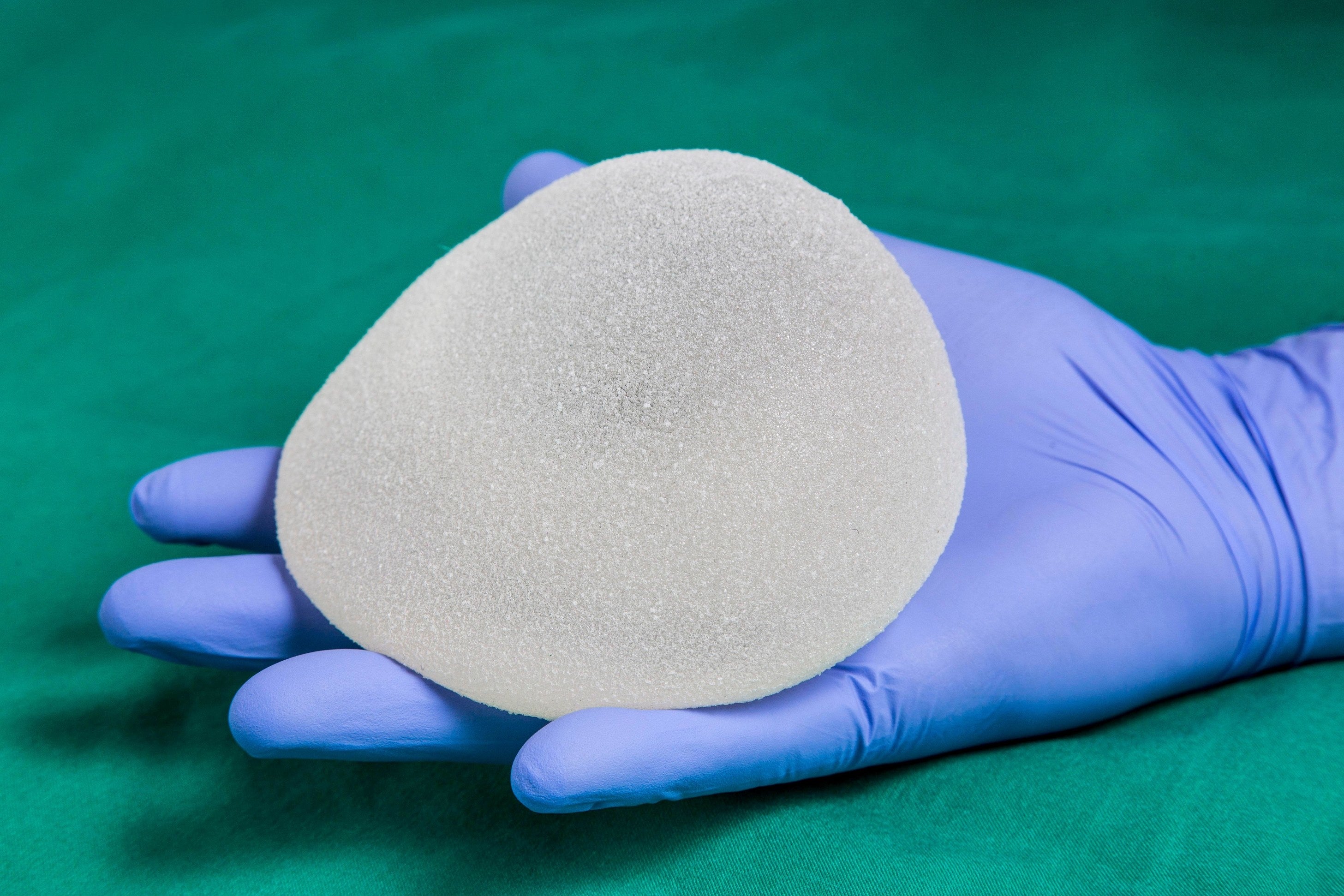 Breast Implants Aren’t Lifelong Devices And Can Cause Health Issues. Here’s What To Know.