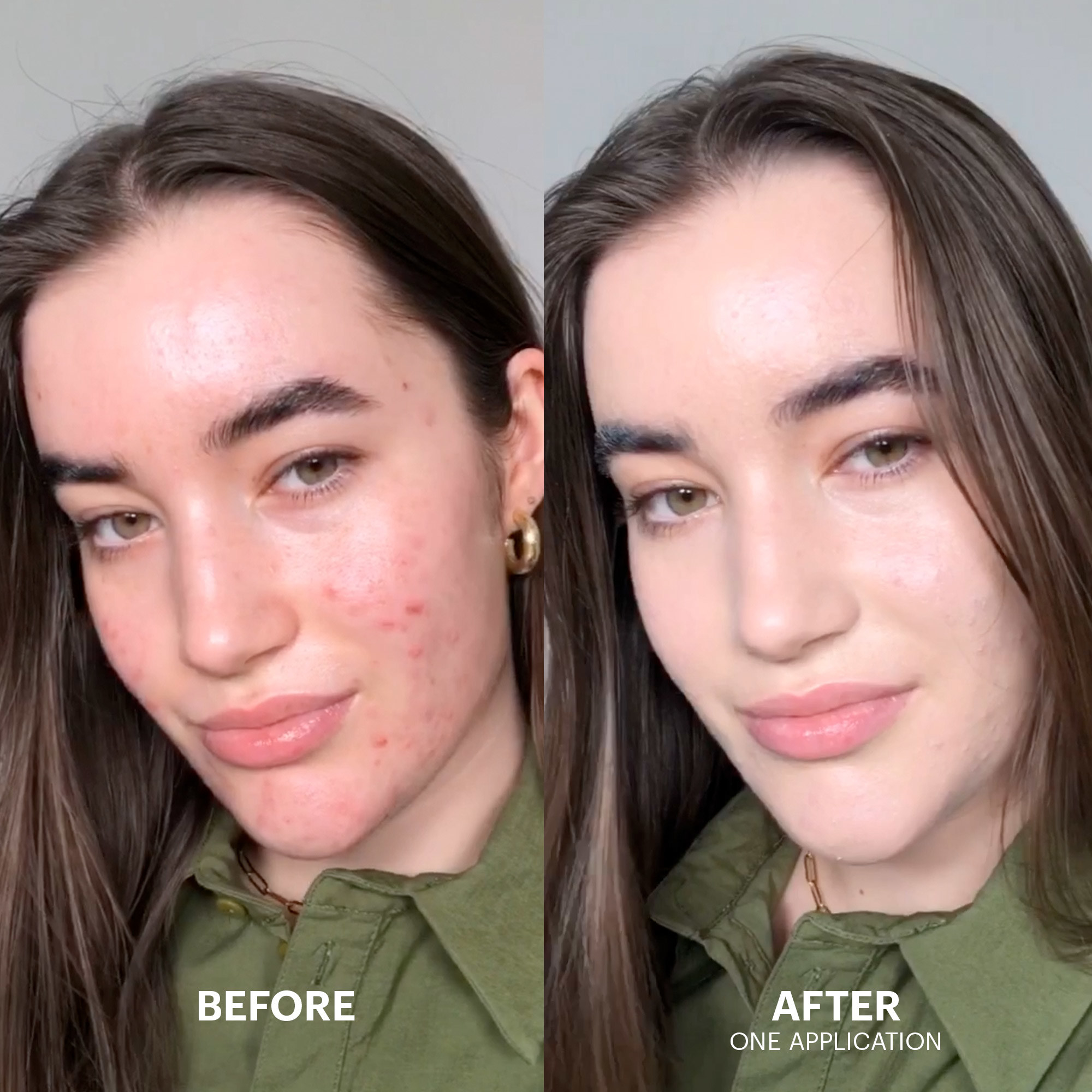 A before and after of someone using the cream