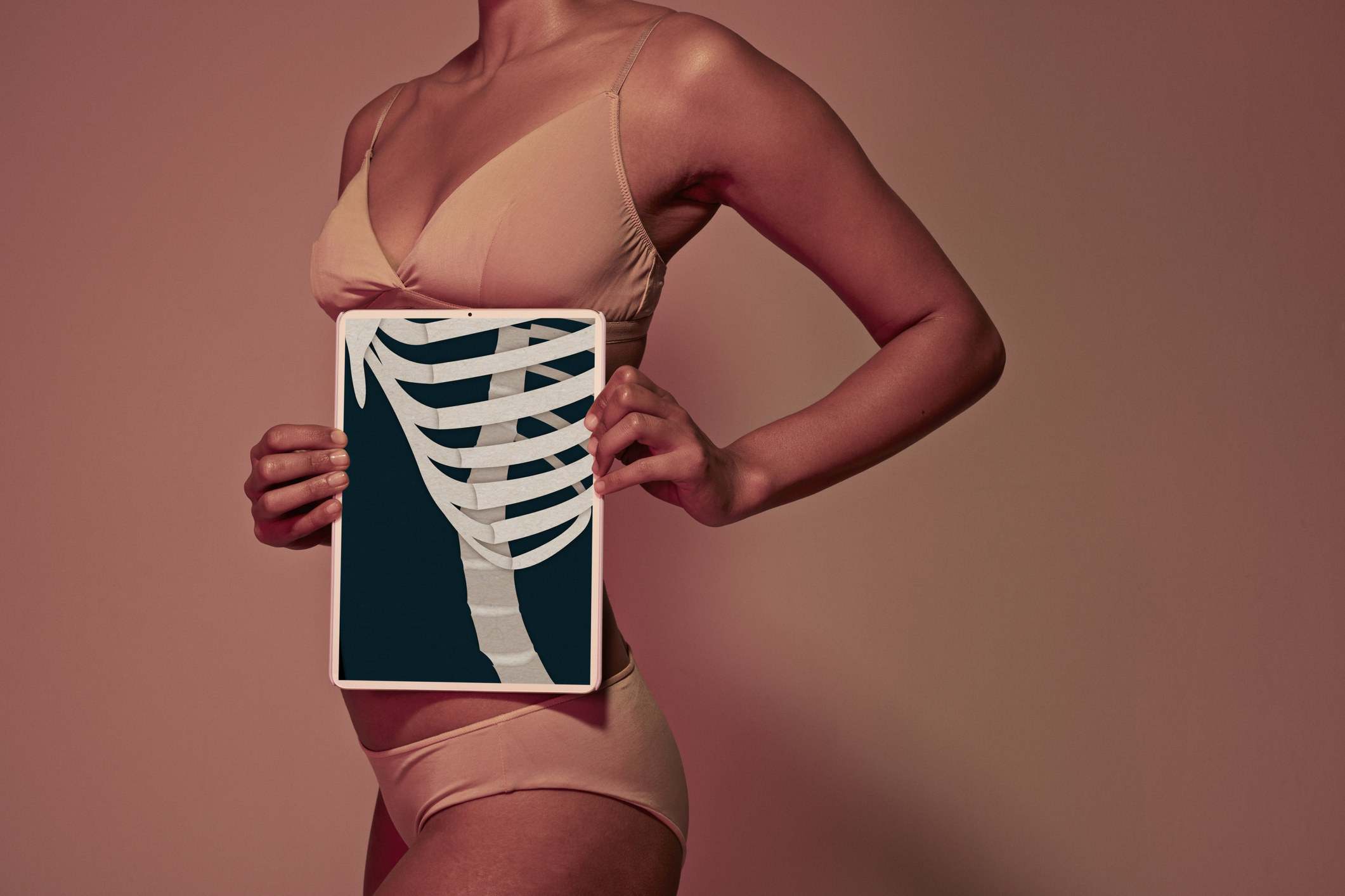 woman holding a rib scan photo