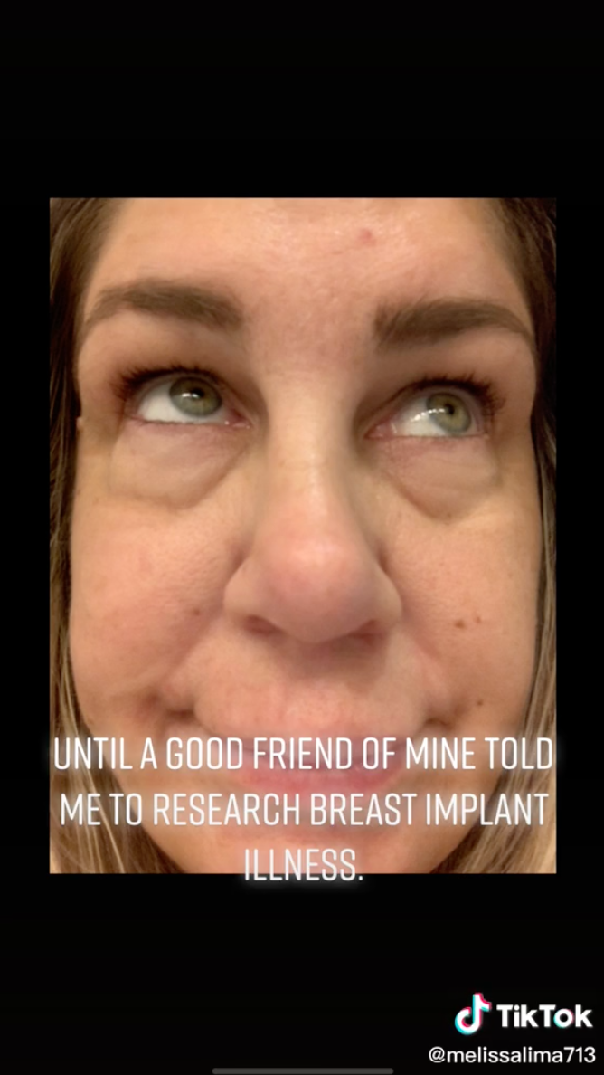 Woman With Breast Implant Illness Goes Viral On TikTok