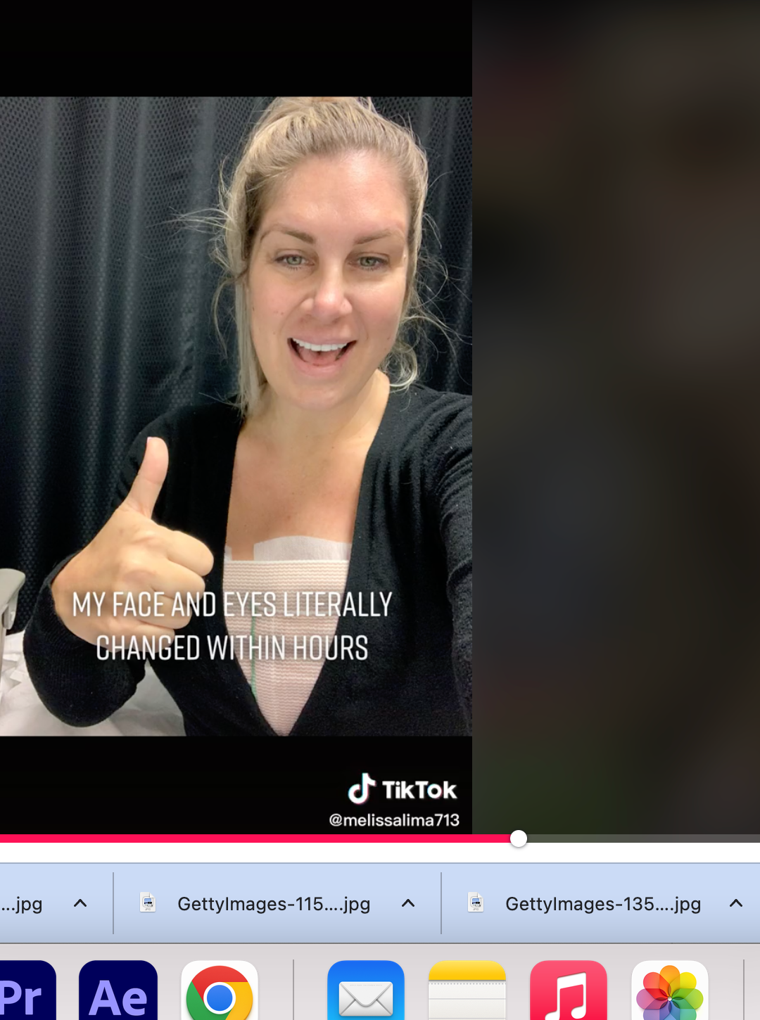 Woman With Breast Implant Illness Goes Viral On TikTok