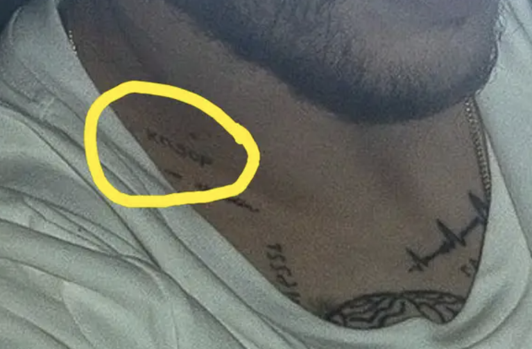 The initials on Pete&#x27;s neck circled