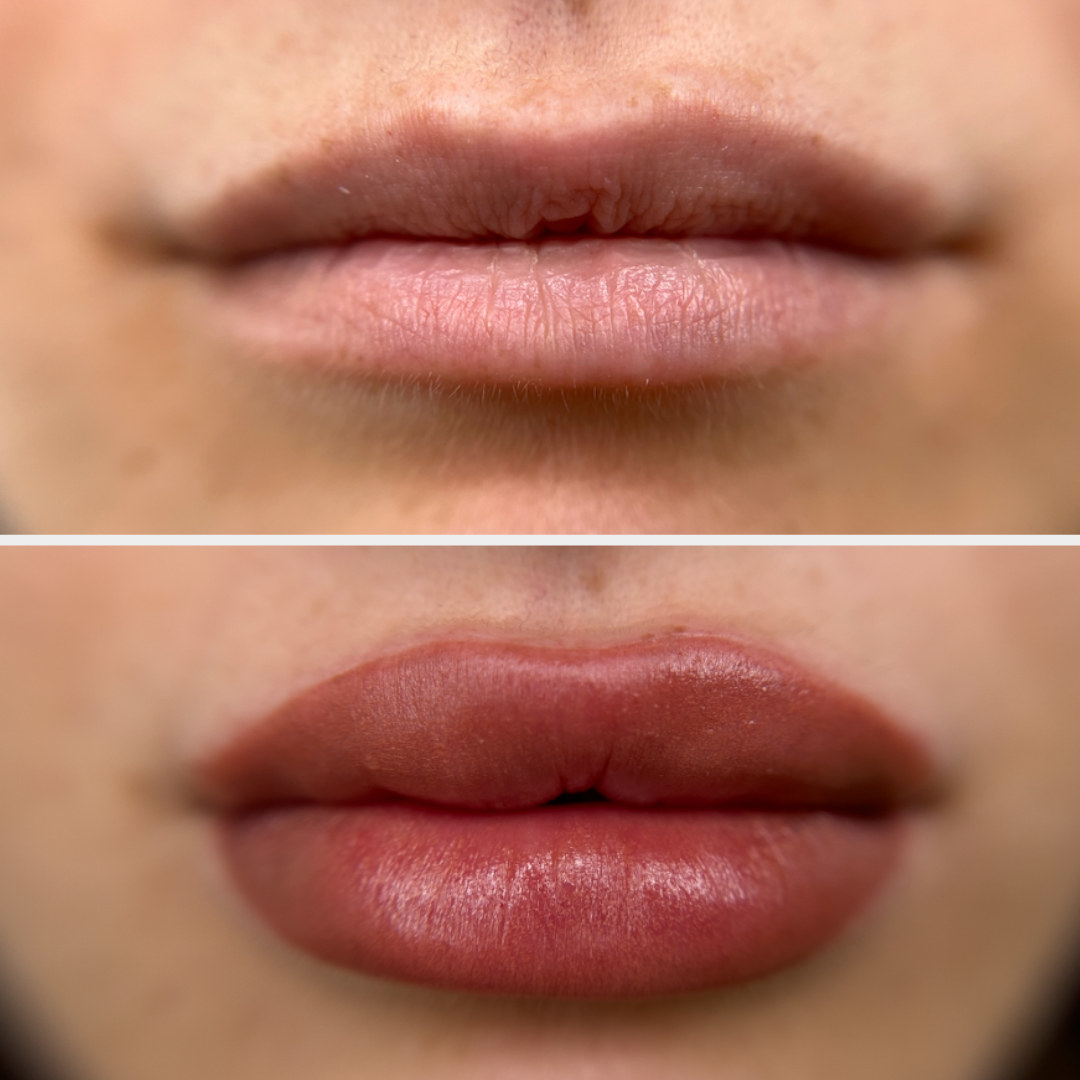 cosmetic #lip #makeup #tattoo #before #after | Permanent makeup, Lip  permanent makeup, Permanent lipstick
