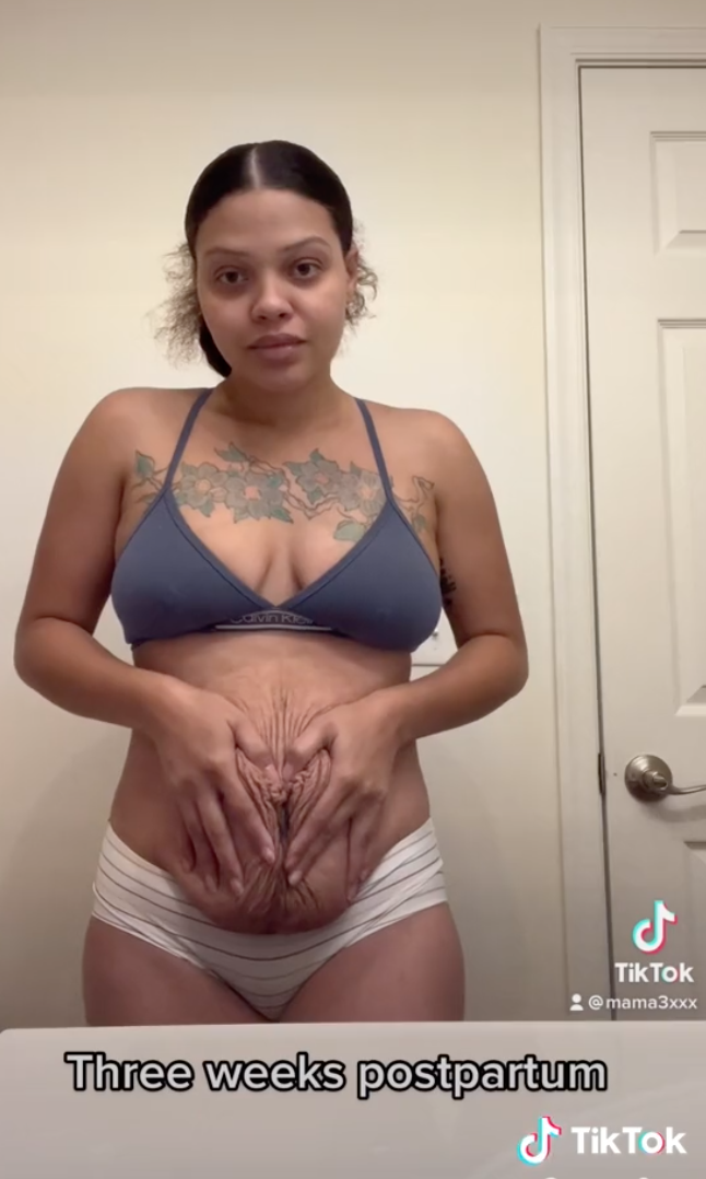 TikTok Mom Shares Photos Of Her Postpartum Body - 95