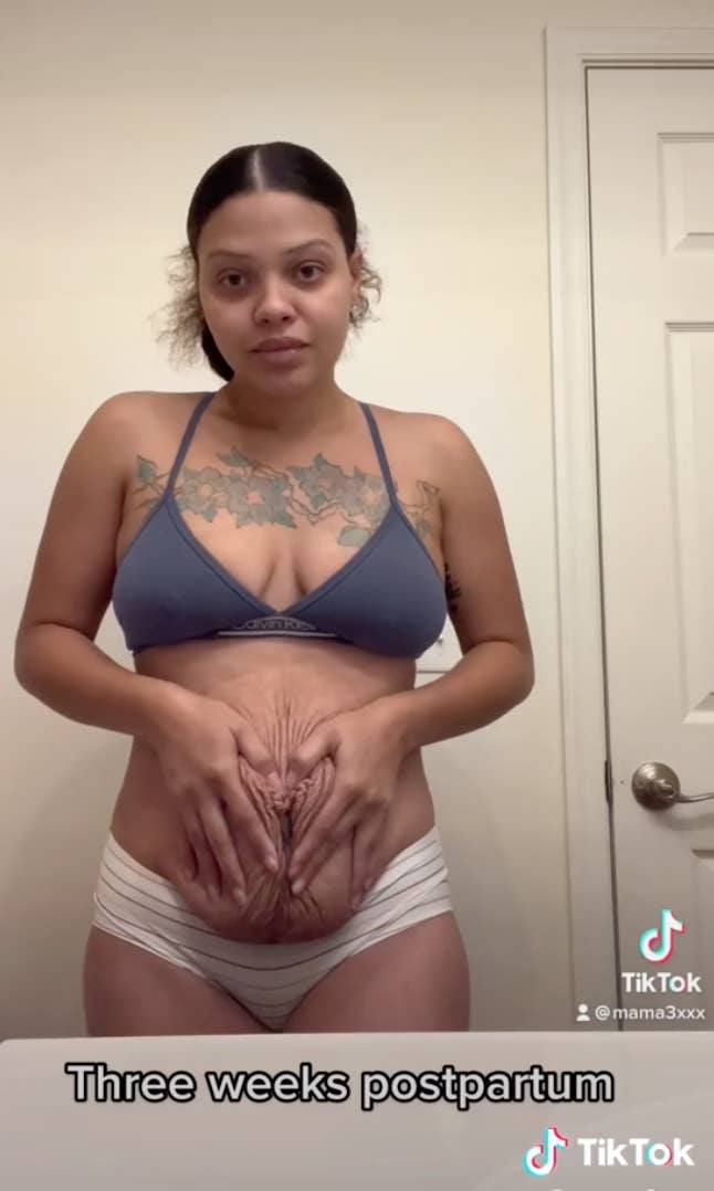 TikTok Mom Shares Photos Of Her Postpartum Body