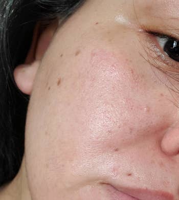 closeup of a reviewer's cheek showing their skin looks soft and hydrated after using the moisturizer
