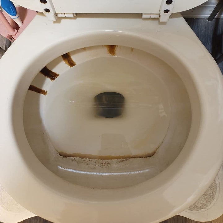 A dirty toilet bowl
