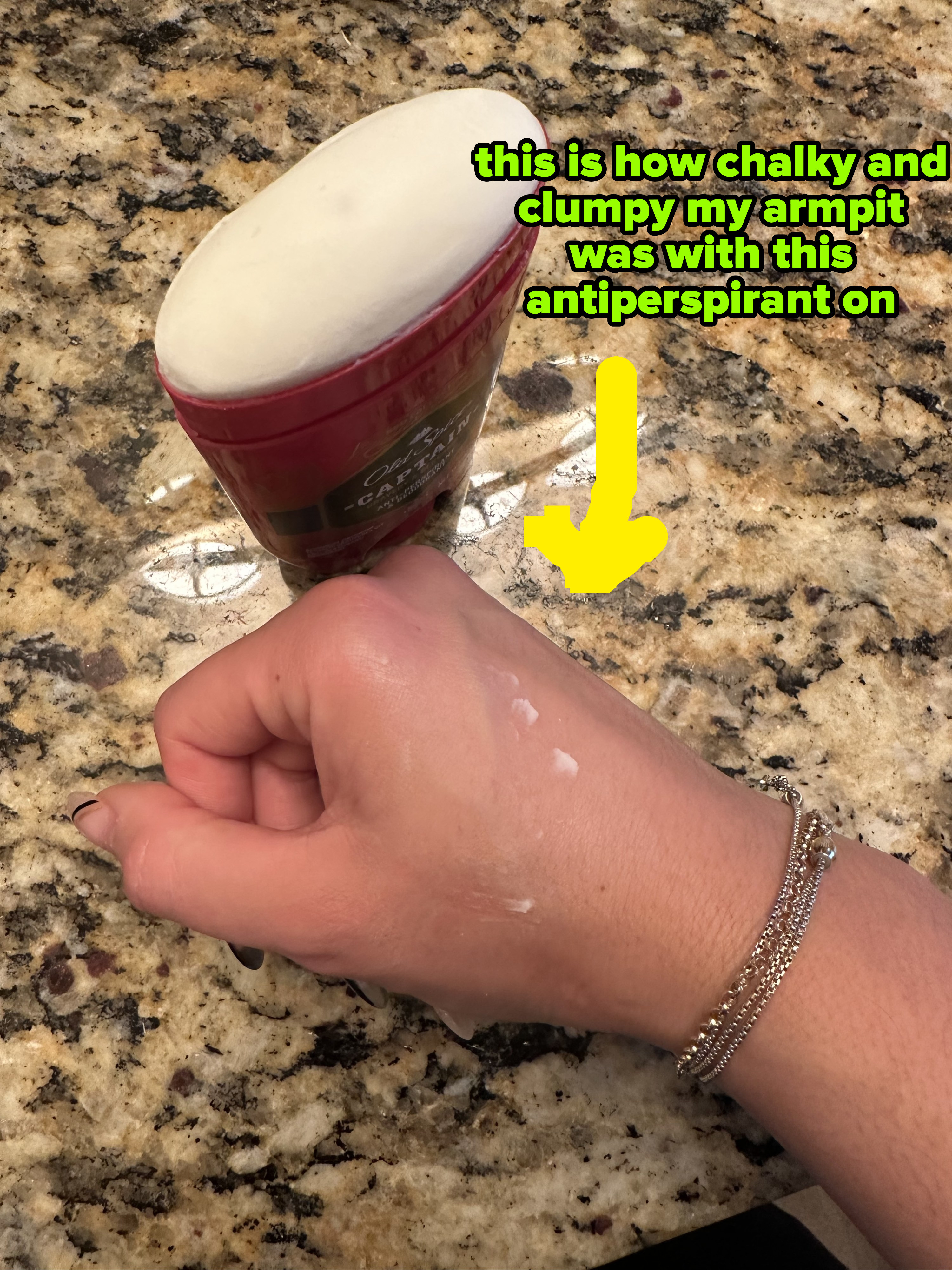 the clump of applied deodorant on the author&#x27;s hand