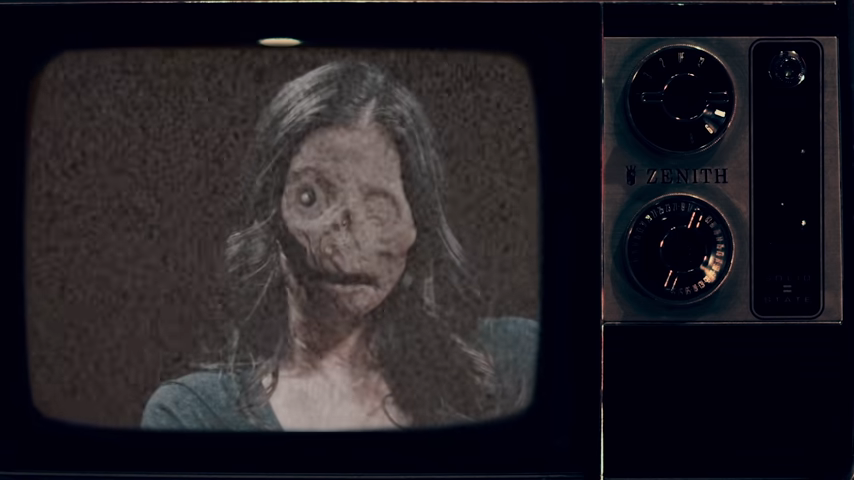 the disfigured woman on TV