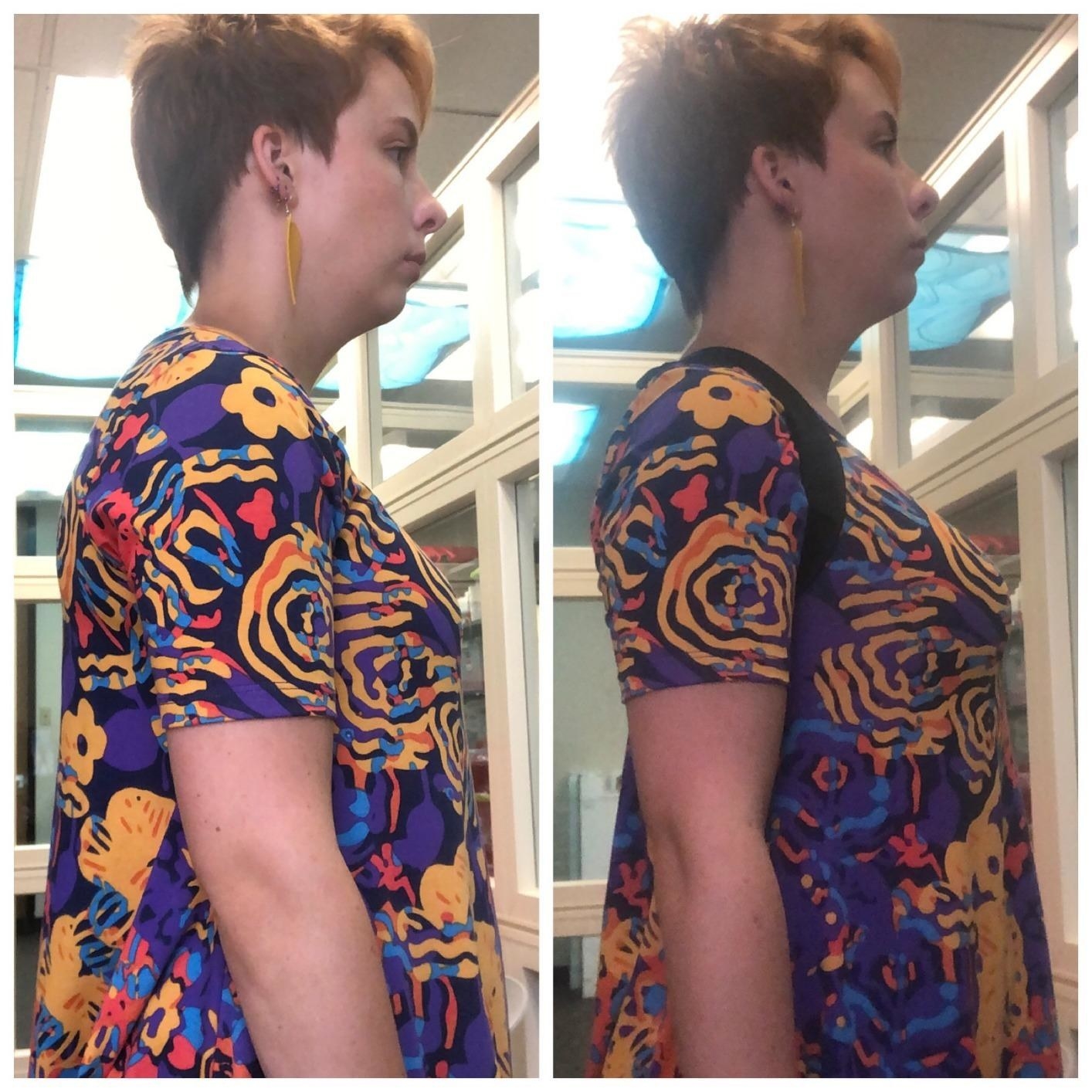 reviewer showing before and after results with the back brace