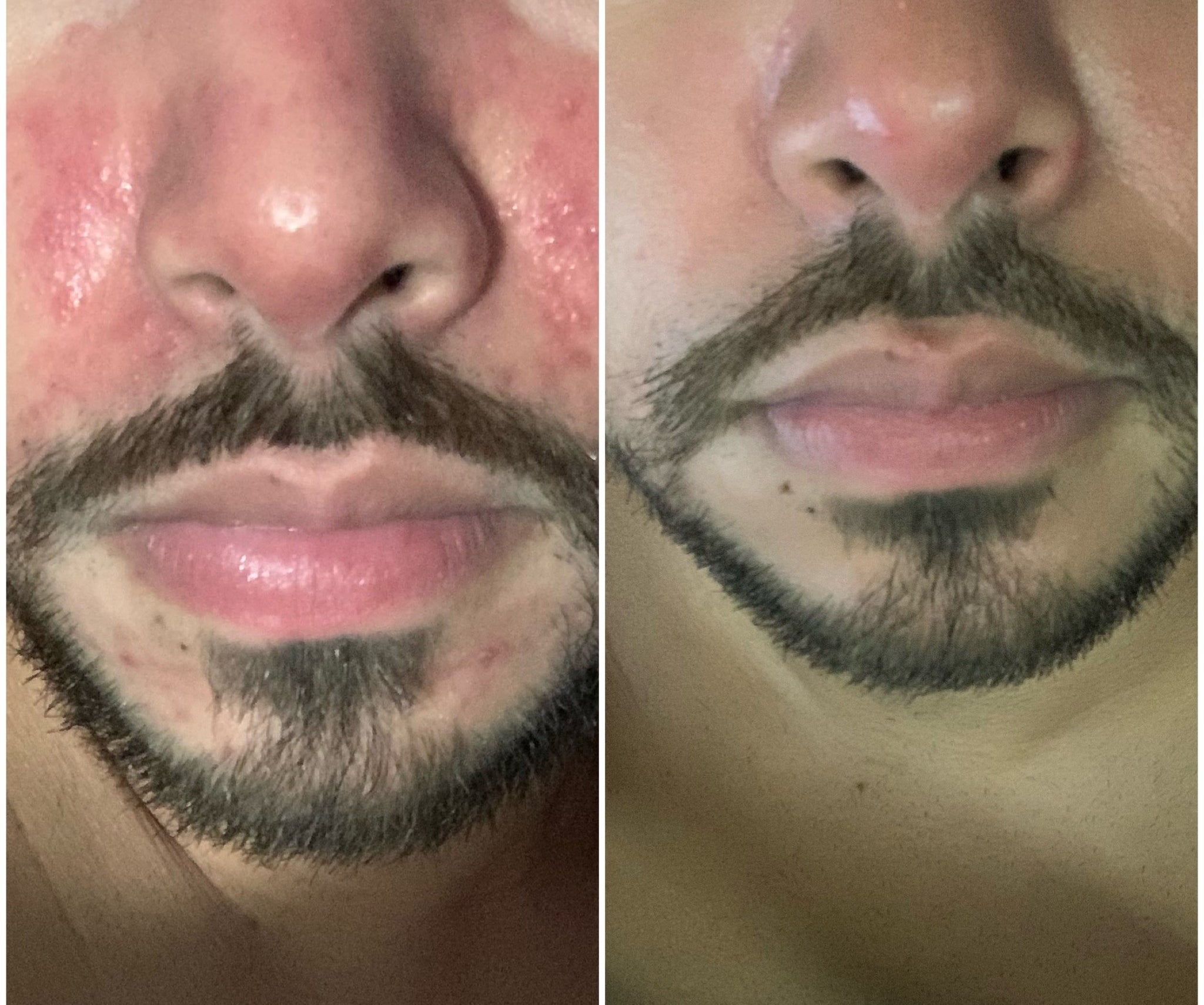 before and after a reviewer using this sunscreen
