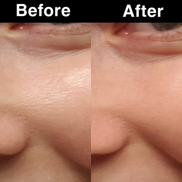 Reviewer's before (left) showing oily close-up of skin under eyes vs. after (right) with same are dry. No filter