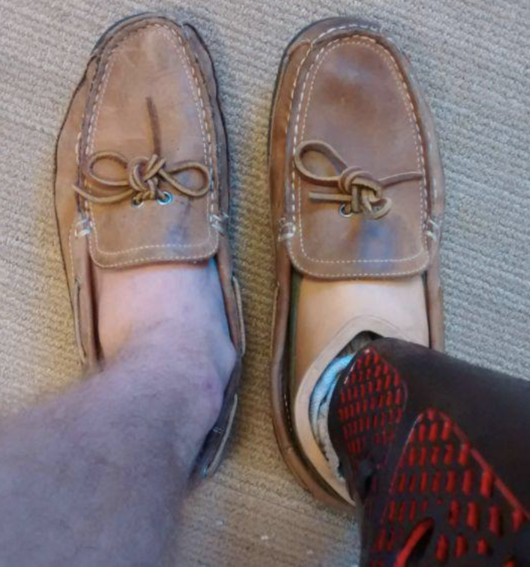 The moccasin-type shoe is more worn by the regular leg and foot than by the prosthetic leg and foot