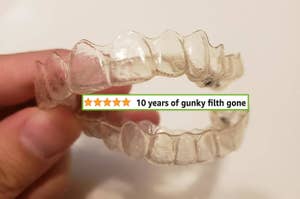 The Invisalign looking significantly cleaner "10 years of gunky filth gone"