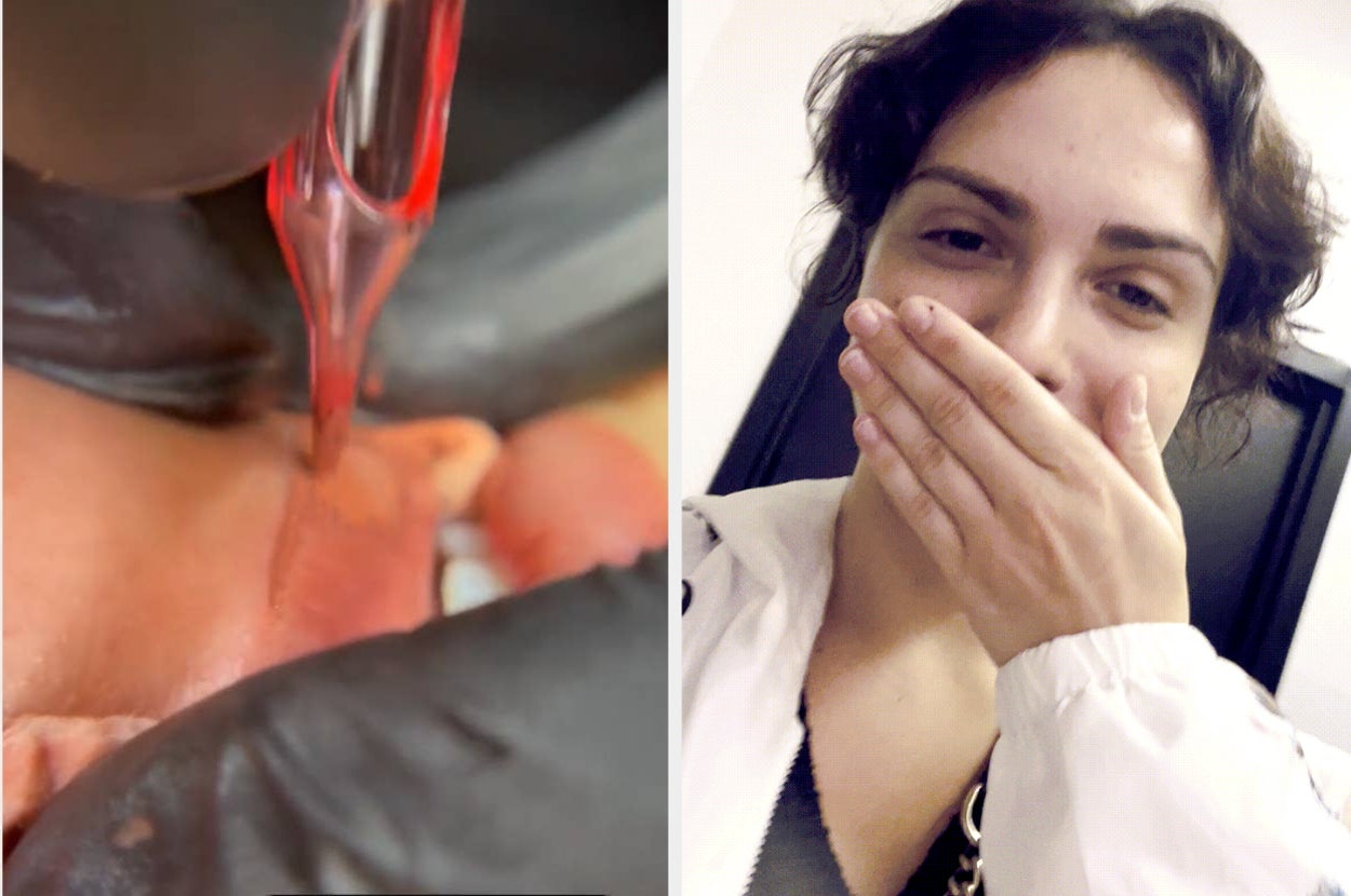 me getting my lips tattooed and me covering my mouth