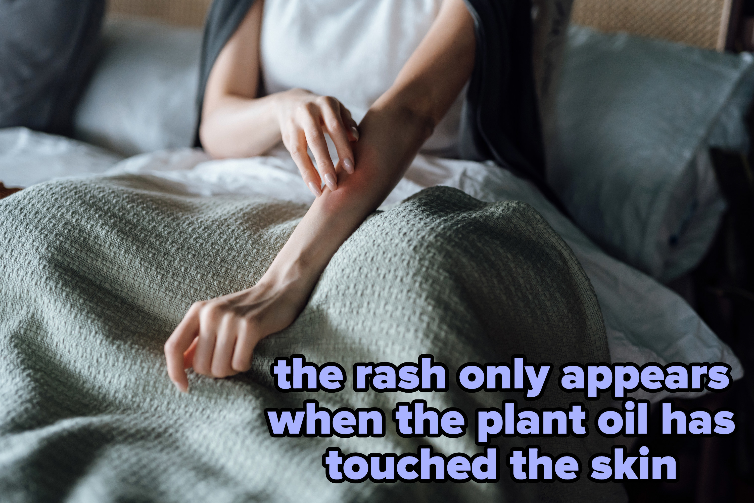 A person scratching their arm with the caption, &quot;The rash only appears when the plant oil has touched the skin&quot;