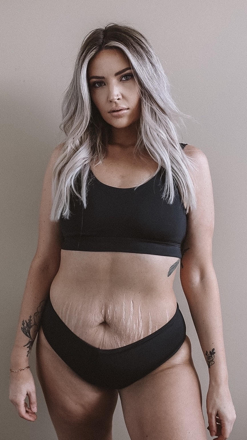 This Mom Is Embracing Her Postpartum Stretchmarks - 10