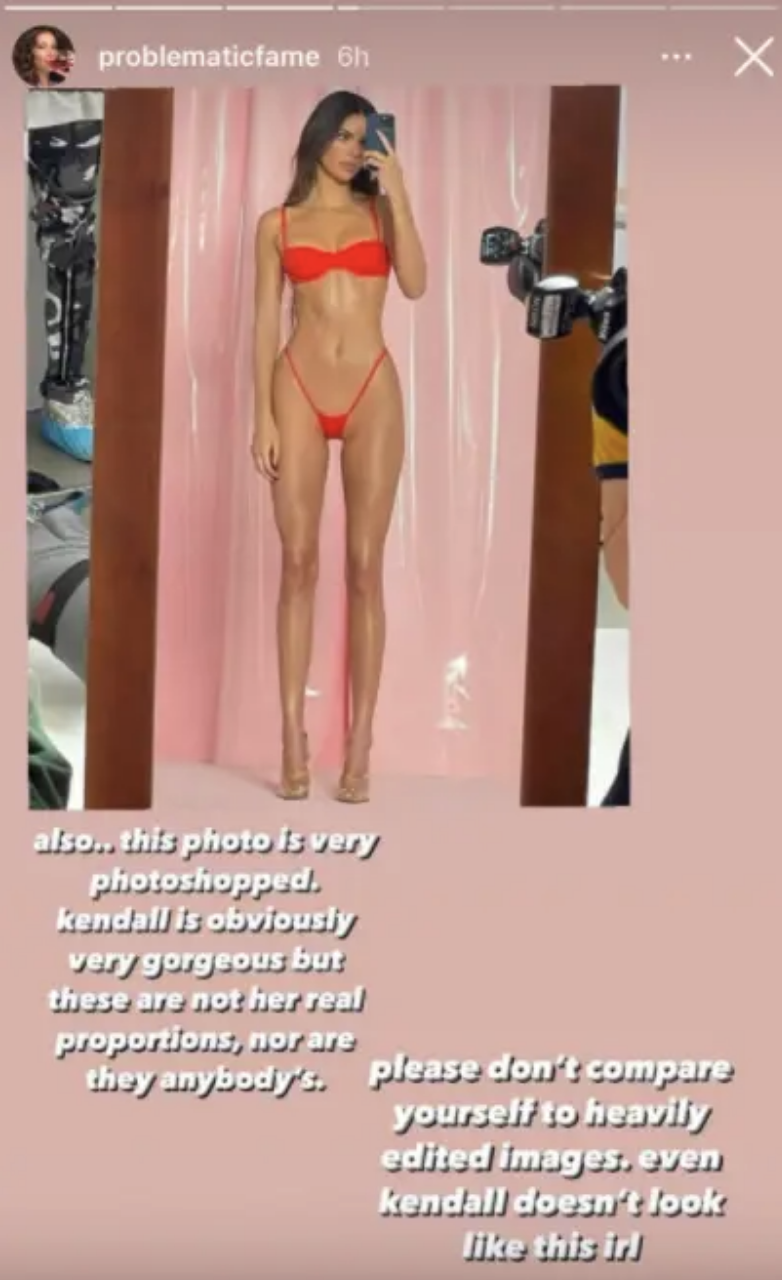 Kendall Jenner Is Being Accused Of Photoshopping Those