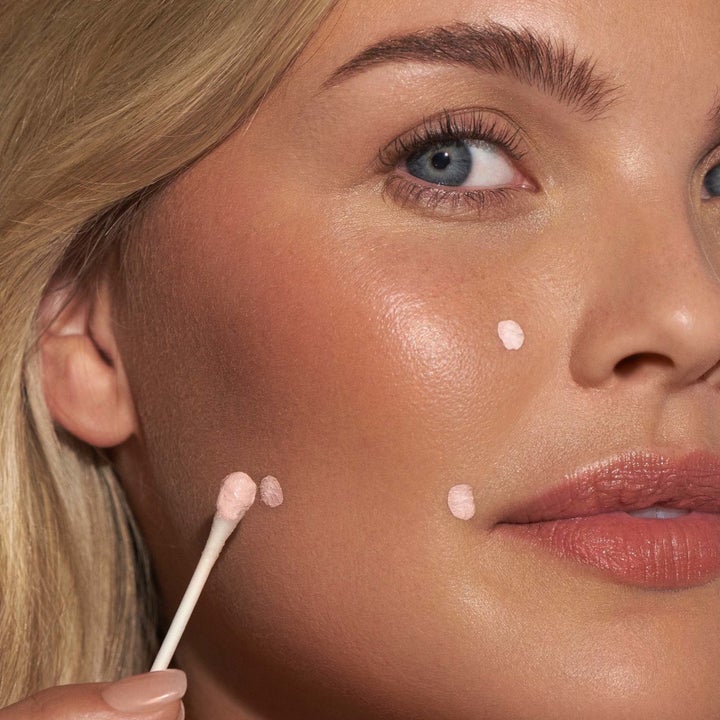 person dotting the lotion with a q tip on their face