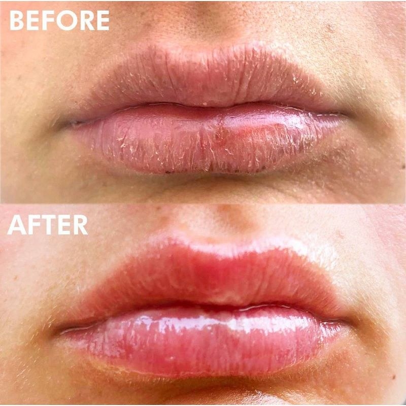 A before and after photo of lips after using product