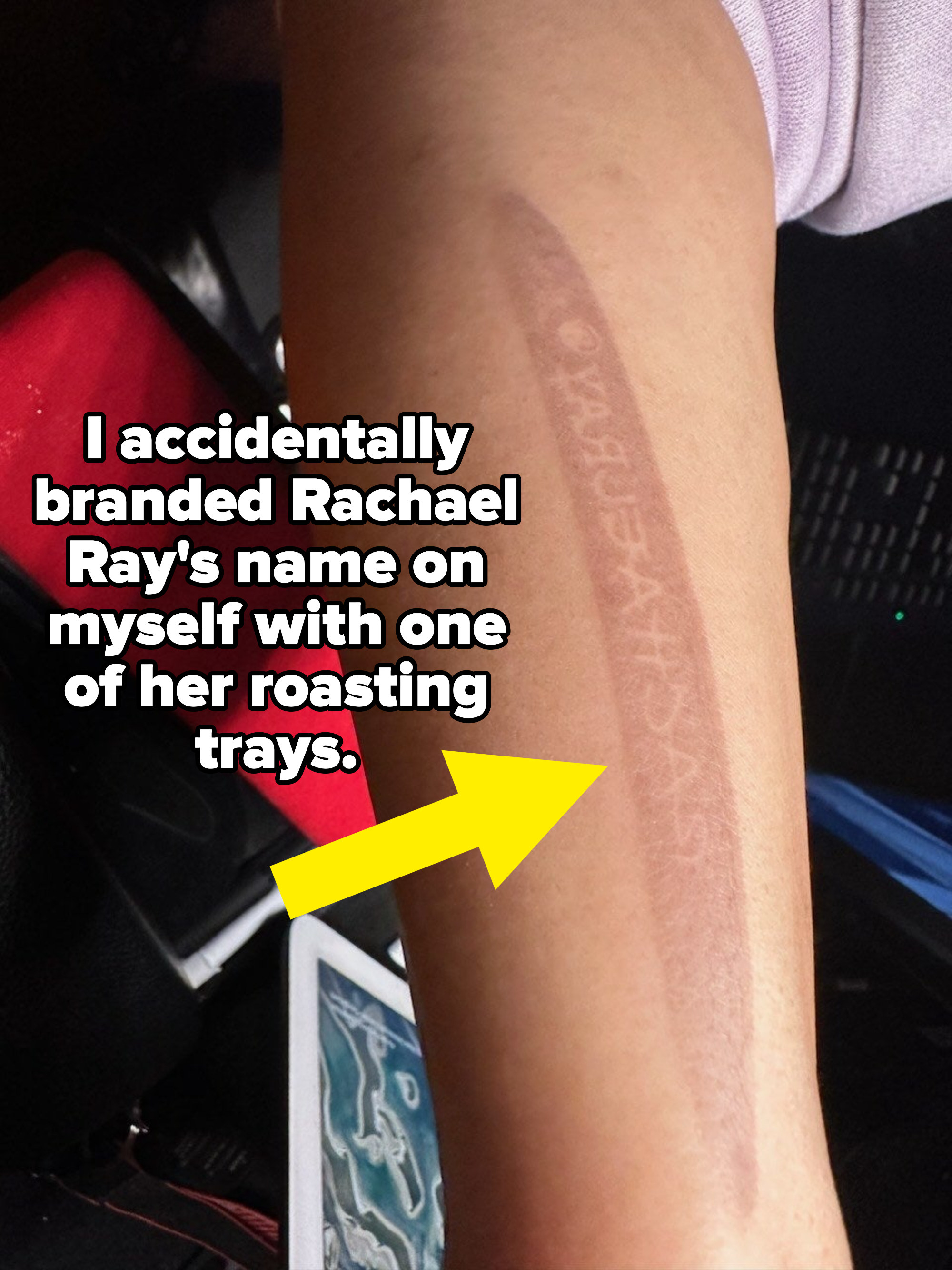 Caption: I accidentally branded Rachael Ray&#x27;s name on myself with one of her roasting trays