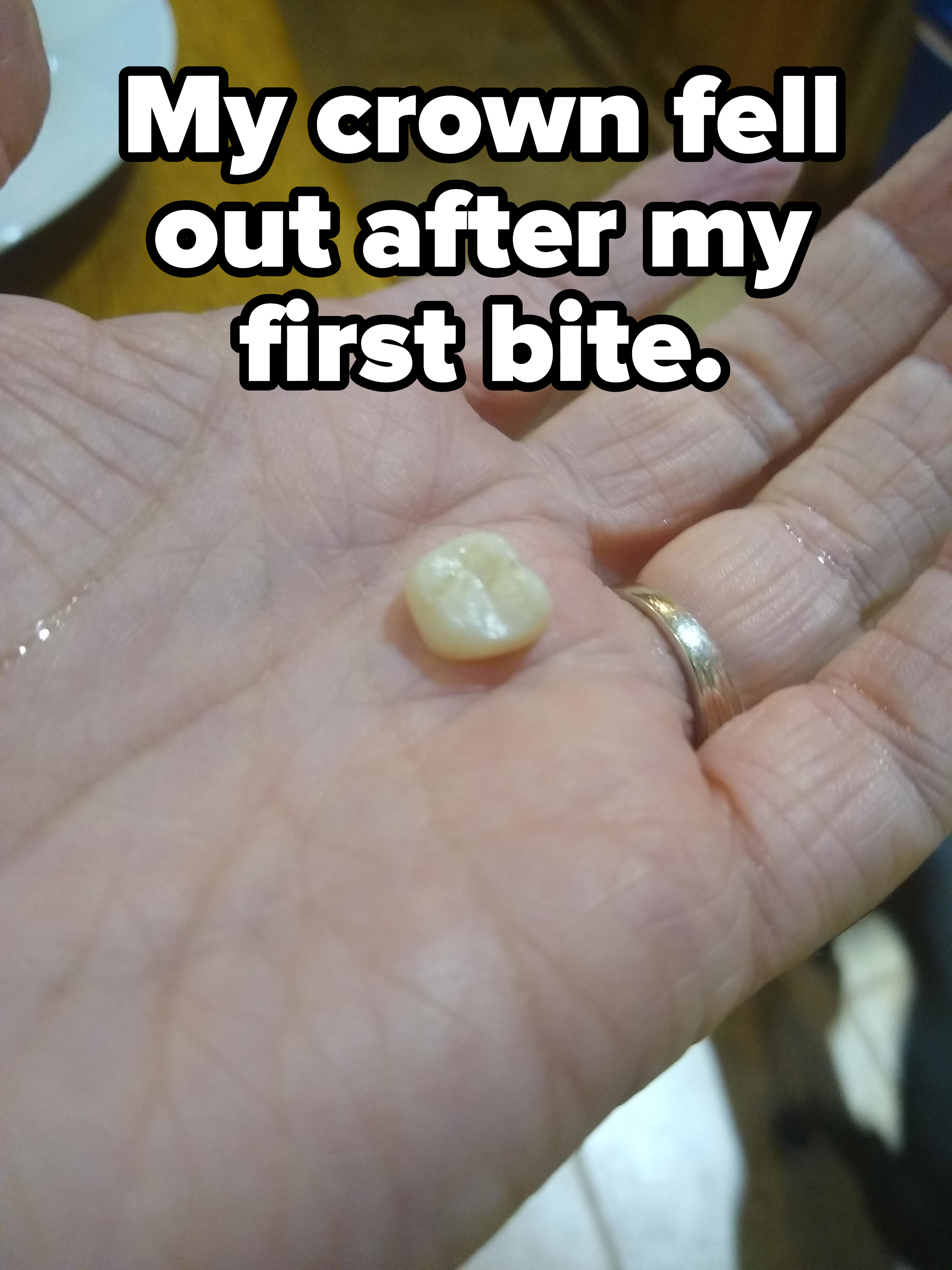 A tooth with crown in the palm of a hand with the caption &quot;My crown fell out after my first bite&quot;