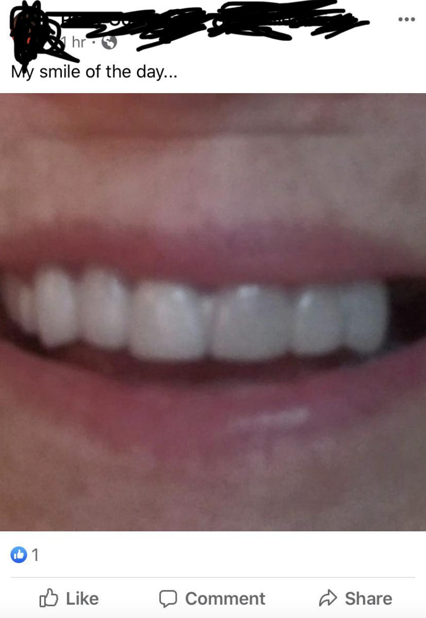 &quot;My smile of the day&quot; and a large close-up of smiling mouth and teeth