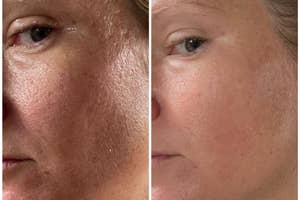 A reviewer's skin before and after use, with reduced texture
