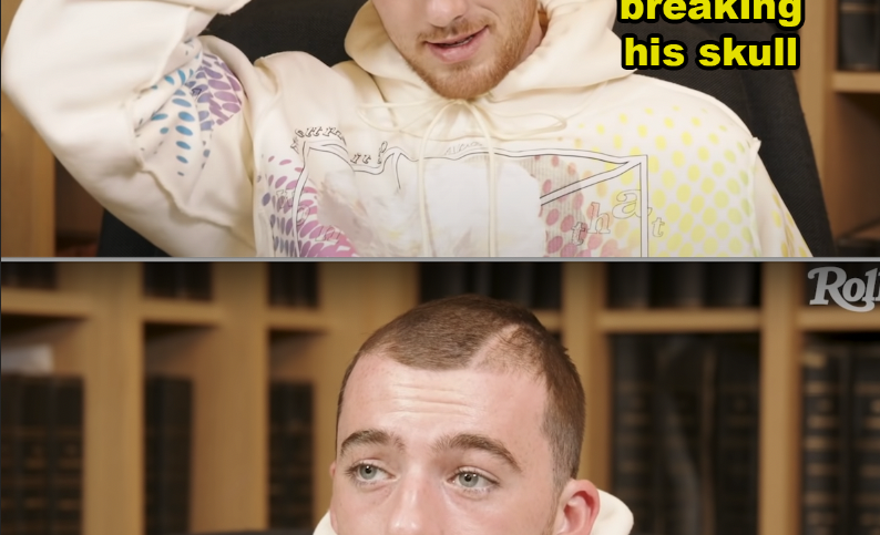 Angus in an interview where the scar on his scalp is visible