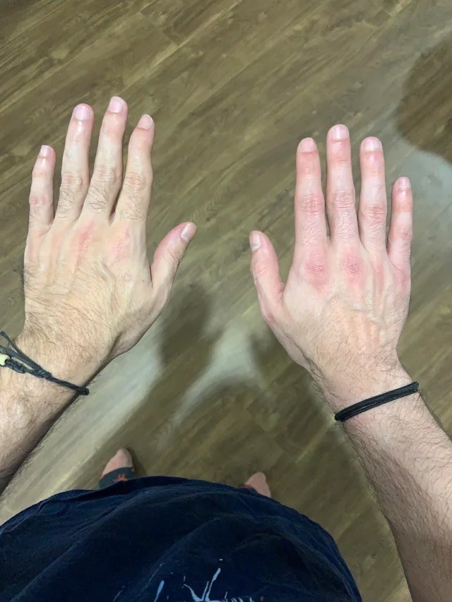 Hand on the left is pale with bendy fingers, the one on the right is more red with straight fingers