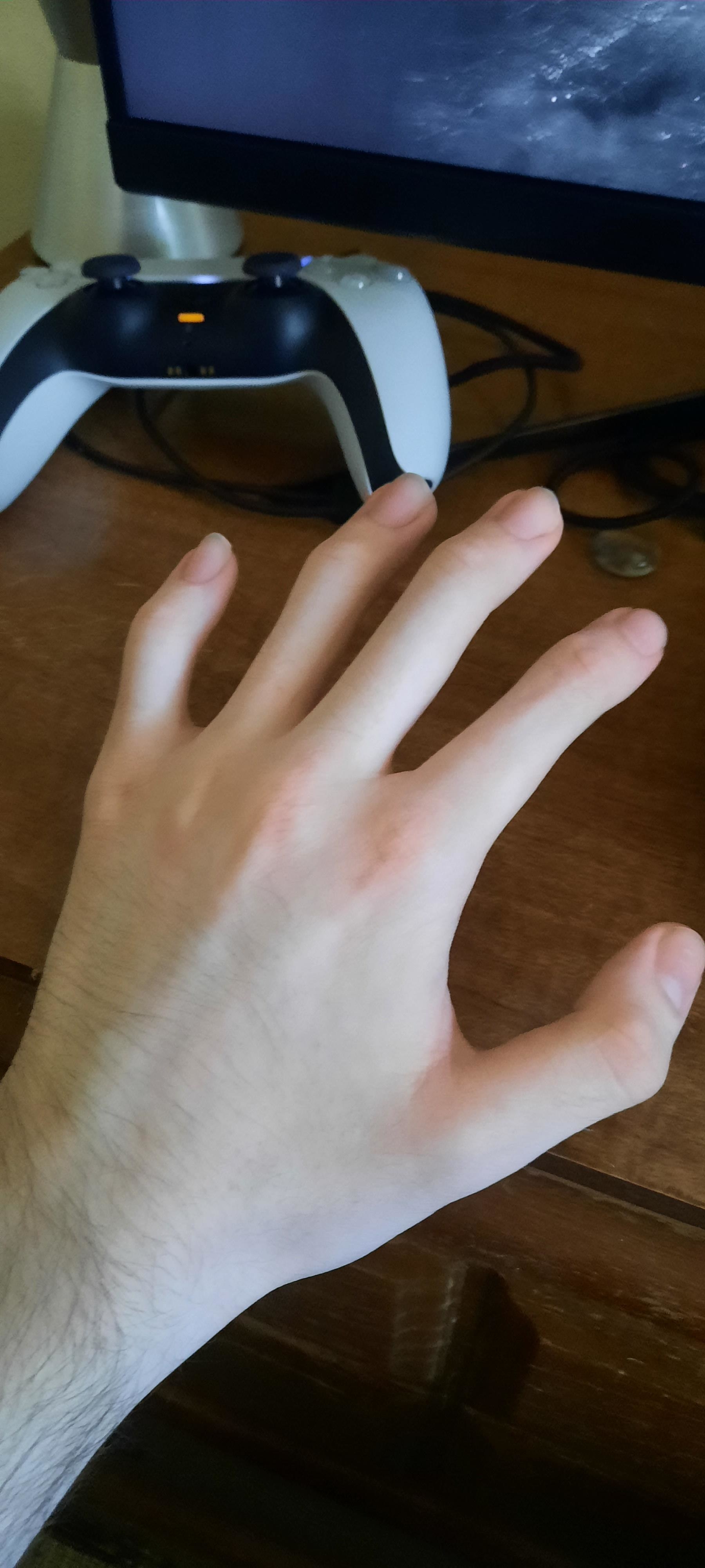 A hand that only has knuckles near the top on each finger