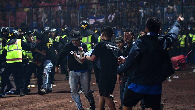 At least 125 are dead after a crowd stampede erupted during an Indonesian league soccer match at Kanjuruhan Stadium in Malang, a city in East Java.