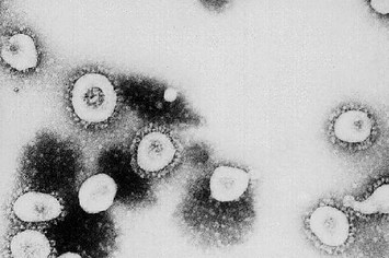 This undated handout photo from the CDC shows a microscopic view of the Coronavirus.