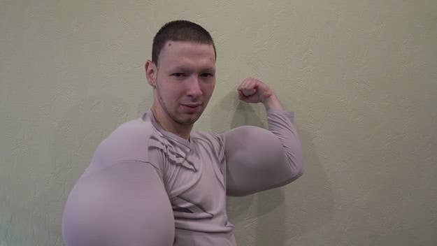 The 23-year-old became semi-famous after it was discovered that he injected synthol into his arms to make them cartoonishly large.