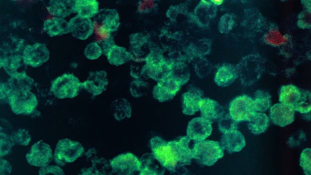 Health officials officials are testing the water in a southwest Iowa lake for a brain-eating amoeba after a Missouri resident was infected last week.