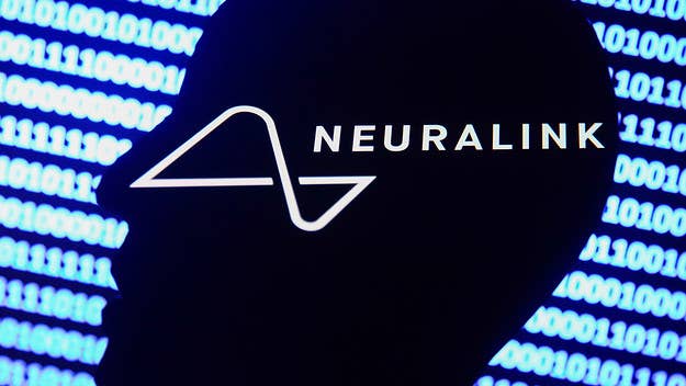 Elon Musk's brain chip company Neuralink, which aims to allow humans to control devices via brainwaves, is now facing serious animal abuse claims.
