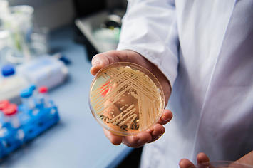 The director of the National Reference Centre for Invasive Fungus Infections holds the yeast candida auris.