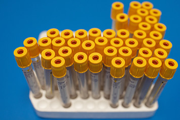 Test tubes to be used for blood samples sit on a table at an antibody testing program.