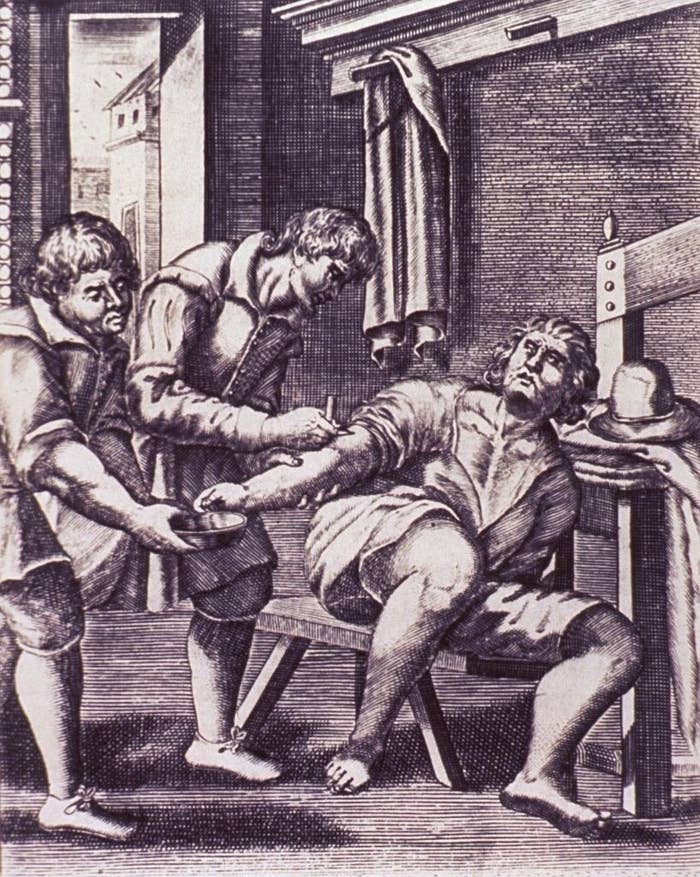 A man sitting on a bench is having his arm cut, while an assistant holds a bowl to collect the blood, 1671