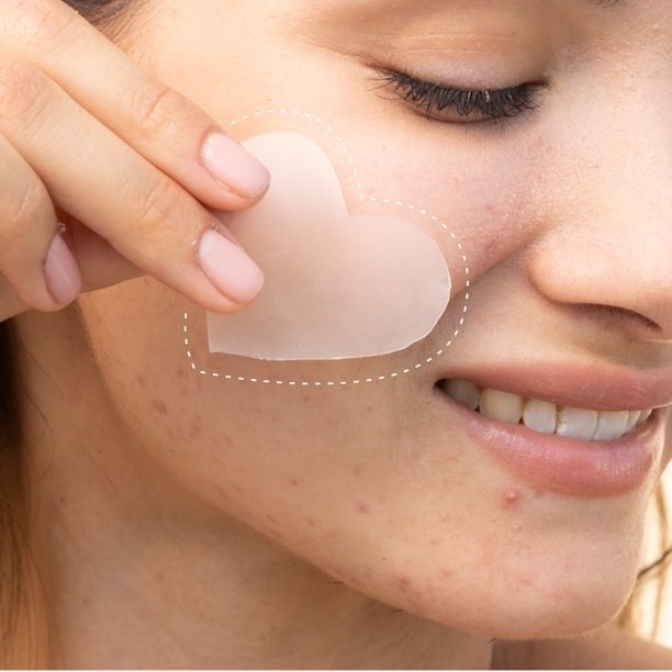 Model using the acne patch