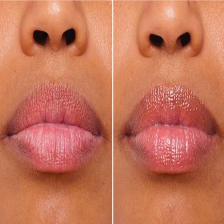 20 Things Anyone With Dry Lips Needs In Their Life